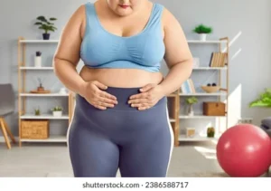 imagem de uma mulher com obesidade